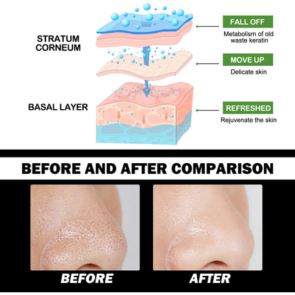 Mascarilla eliminadora de espinillas de carbón de bambú, limpieza profunda, purificadora de poros, crema exfoliante para Control de aceite, mascarilla de barro para el cuidado de la piel