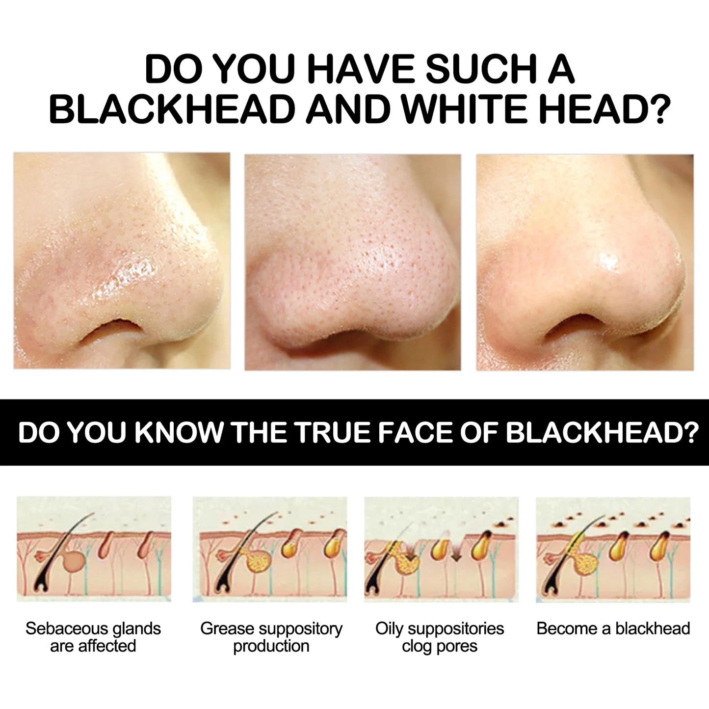 Mascarilla eliminadora de espinillas de carbón de bambú, limpieza profunda, purificadora de poros, crema exfoliante para Control de aceite, mascarilla de barro para el cuidado de la piel